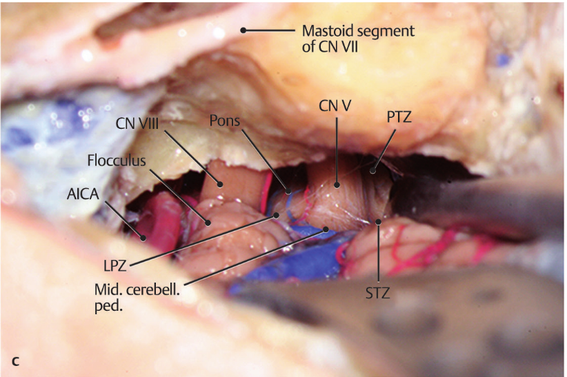 Close-up of a human body AI-generated content may be incorrect.