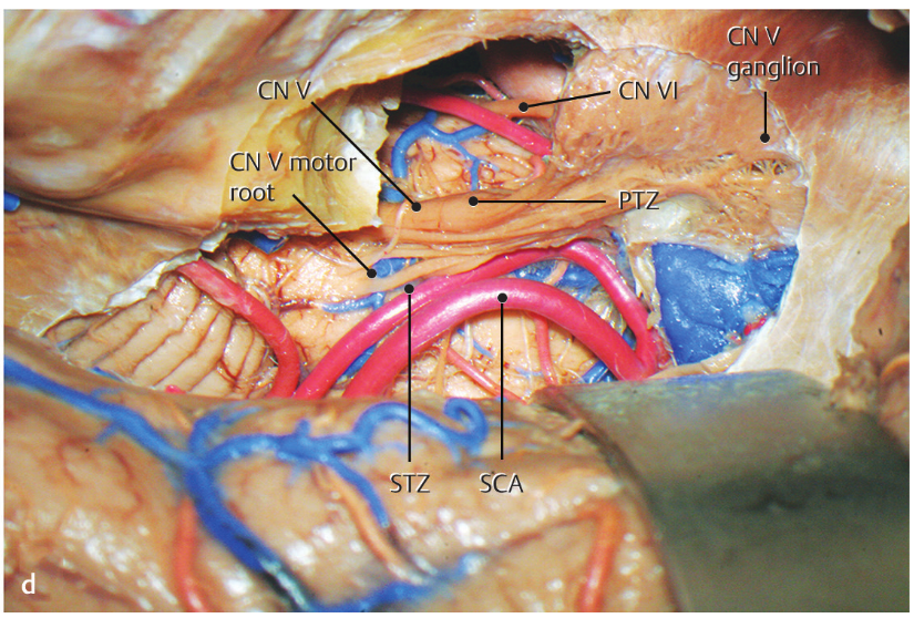 A close-up of a human body AI-generated content may be incorrect.