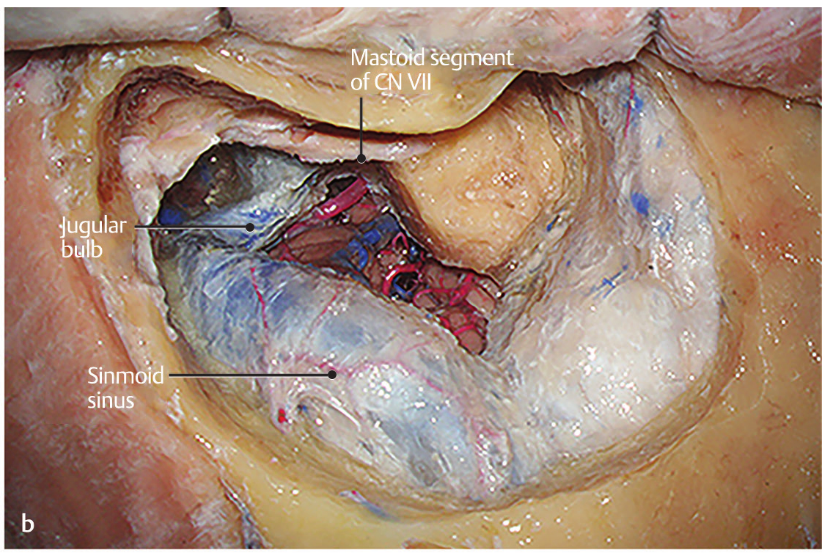 Close-up of a human body AI-generated content may be incorrect.