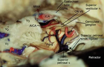 Close-up of a human brain anatomy AI-generated content may be incorrect.