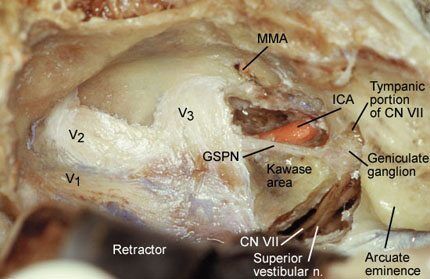 Close-up of a human body anatomy AI-generated content may be incorrect.