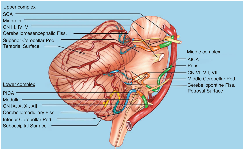 Upper complex SCA Midbrain CN Ill, IV, V Cerebellomesencephalic Fiss. Superior Cerebellar Ped. Tentorial Surface PICA Medulla CN X, Xl, Xll Cerebellomedullary Fiss. Inferior Cerebellar Ped. Suboccipital Surface Middle complex AICA Pons CN VI, Vil, Vill Middle Cerebellar Ped. Cerebellopontine Fiss., Petrosal Surface 