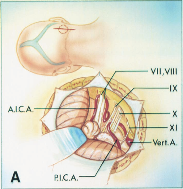 VII ,VIII IX A.I.C.A. XI Vert.A. PI.C.A. 
