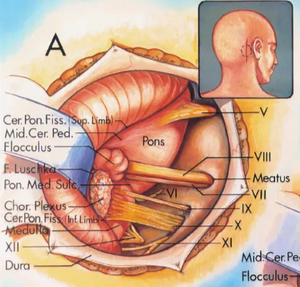 Cer Pon Fiss. Mid.Cer Pee. flocculus Porn. M Cho r. Cerfbn Fi V. of R)n. V.of Mid.Cer VSE C Lai Med. r ped. Carr V ns. pon.V V of Cer. .ic.A. sc.A. AICA. VII,VIII Wrt.A. S.C.A. sal V Vert A, 