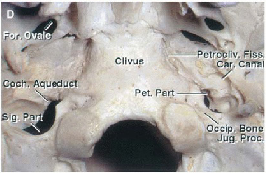 The view directed from anterior and backward reveals the shape of the jugular foramen.