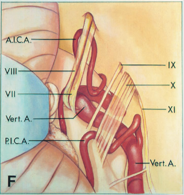 .C.A. IX VIII VII XI A. PI.C.A. Vert.A. 
