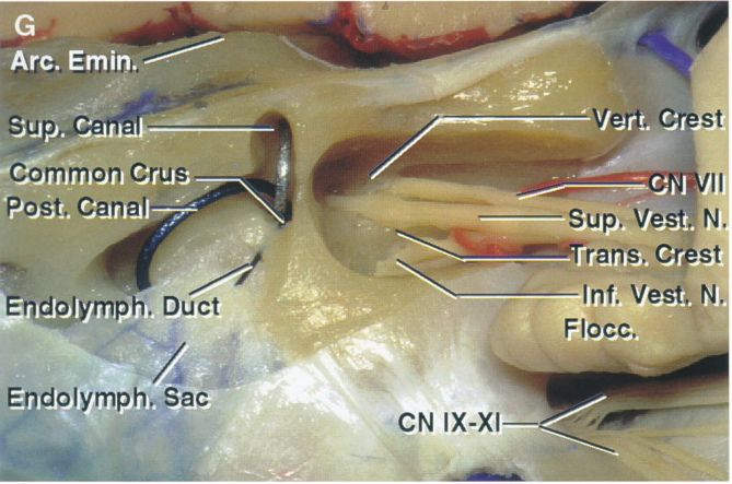 su Common Crus Post. Canal Duct Epdolymph, Sac Erg. Cr Sup. Ve Inf. Vesf. Flbcc. s N. CN IX-XI 