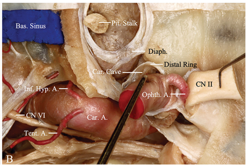 11 NO 1ełs!CI — •qde!ą snu!S •seg 