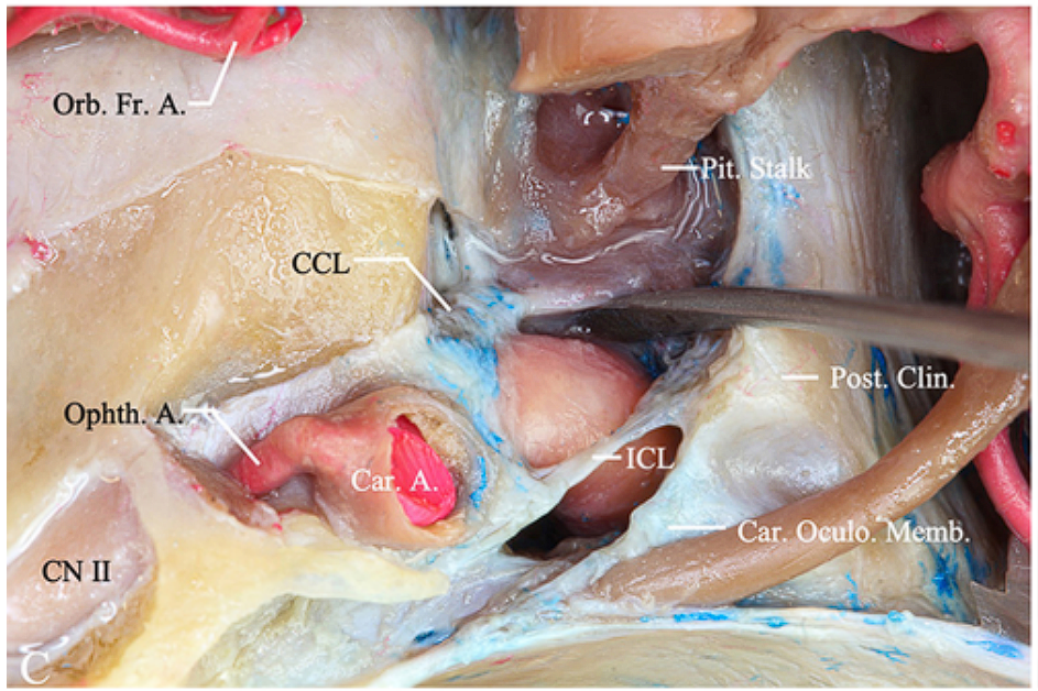 DI V 0 tv•tpqdo 一 一 一 IINO 
