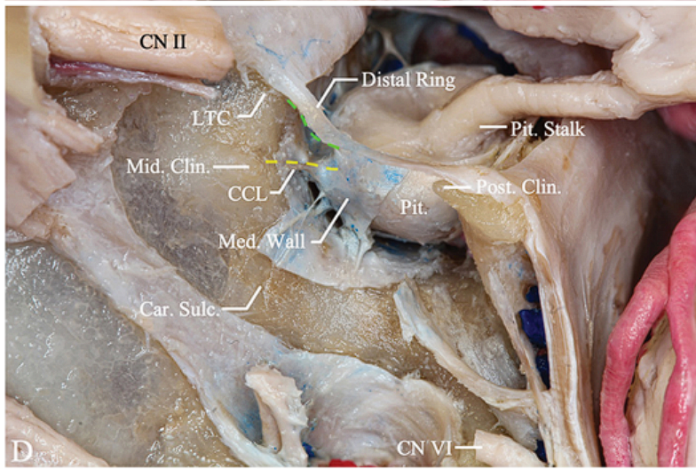 Close-up of a human body anatomy AI-generated content may be incorrect.