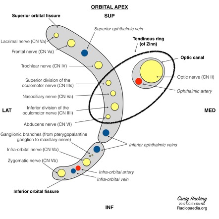 Tendinous ring | Radiology Reference Article | Radiopaedia.org