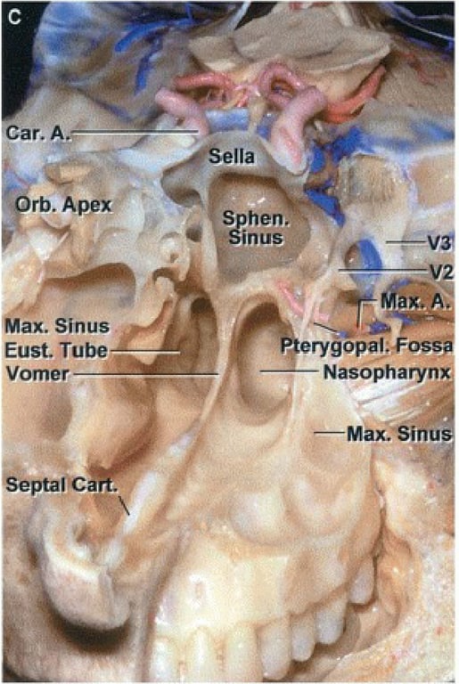 Car. Ae rb. per Max. Sinus Eust. Tube Vomer Septaic ella Sphen. Sinus rygopal.F Nasopharyn æ—MaxSinu 