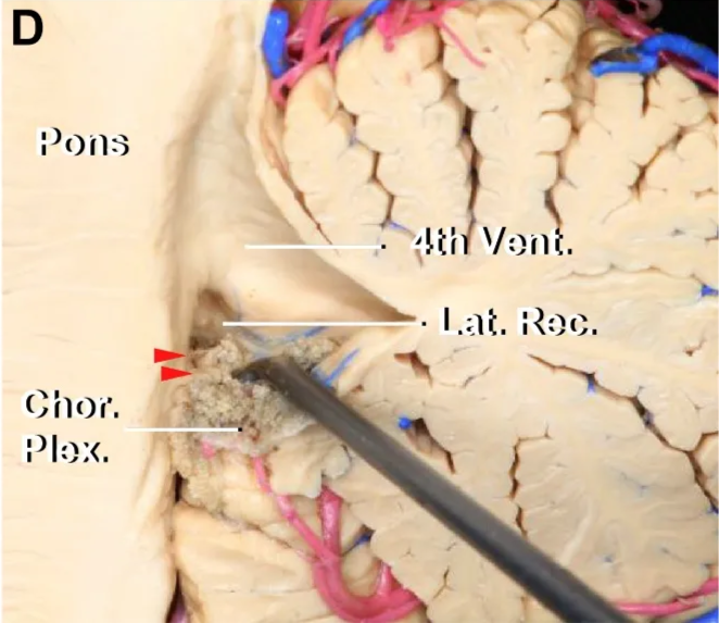 Medial view of the fourth ventricle in the midline. 