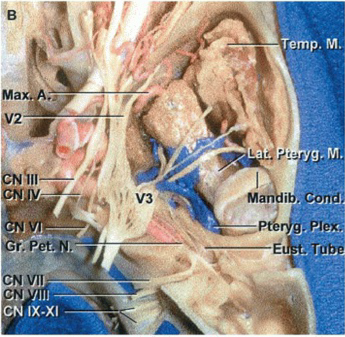 Ма сеч Мап Тетр. М. Ј'ДЈ 