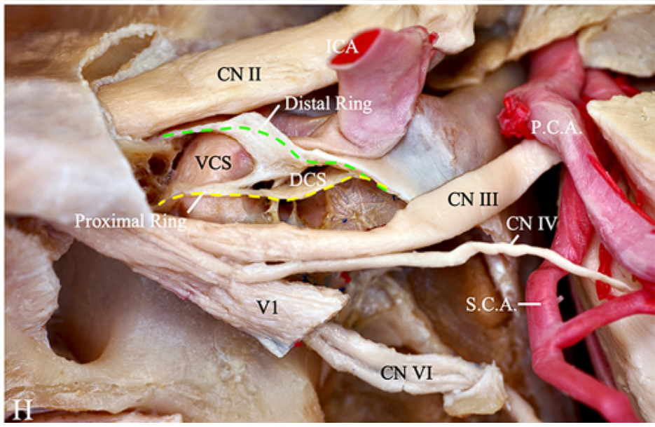 Close-up of a human body AI-generated content may be incorrect.