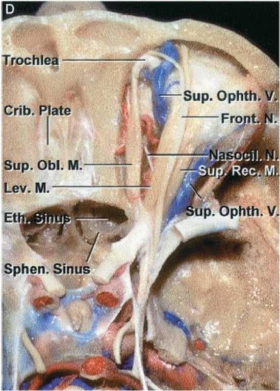 Trochle Crib. ate up. Obi. M. Lev. M. Sphen. inus Sup. Ophth. Fro t. Su up. phthi 