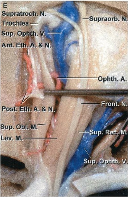 SupratrochiN.— -=Supraorb. Sup. Op phth. A ront. N. A.&N sup. Obl.kF Lev. M. Sup. 