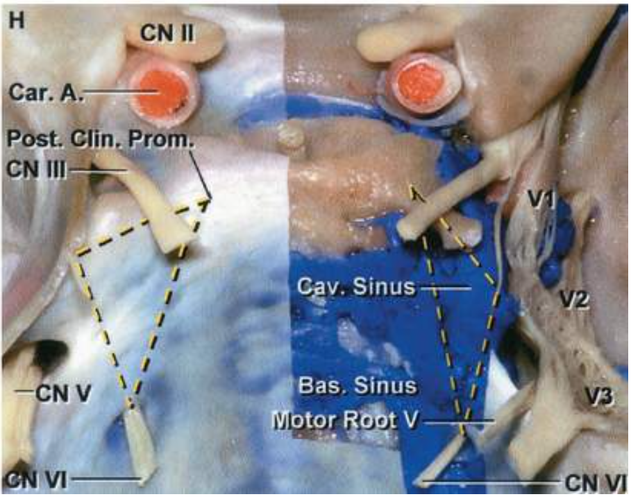 r,qo snu!S •seg snu!S 