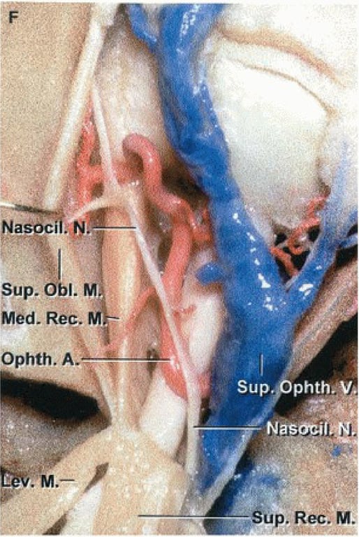 Nasocl . N. sup. l. M Med. Rec. Ophth. Sup. 