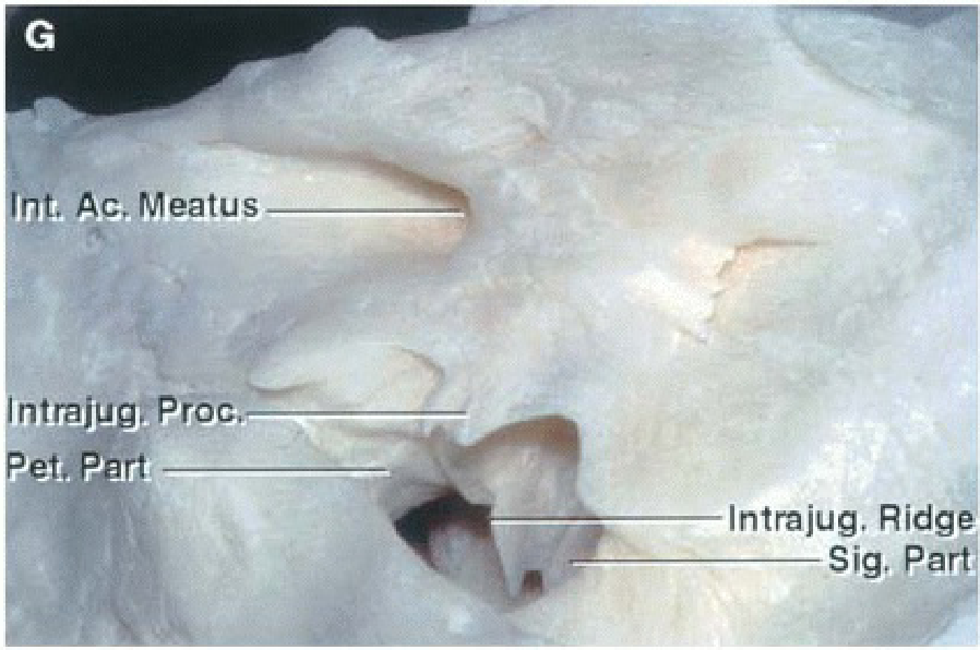 Ihț, AC. Meatus IntrajugťPŕOc. ————lntrajug, Ridg Sig, pa 