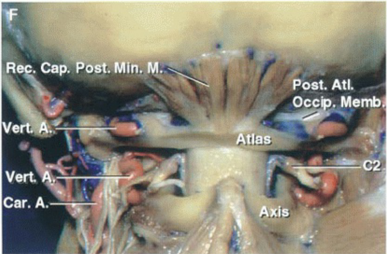 R Сар. Post. Min. М. а Post. AtL Осс . Меть. Atld Vert Саг. А. Axis 