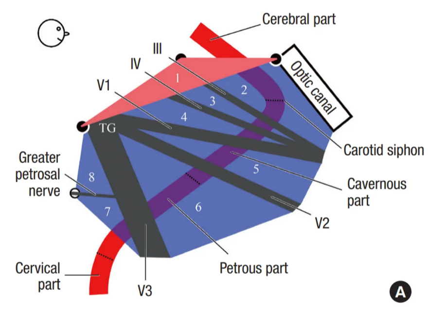 On schematic drawing, each part of the internal carotid artery can be identified through the triangles except lateral and medial triangles of the posterior group.