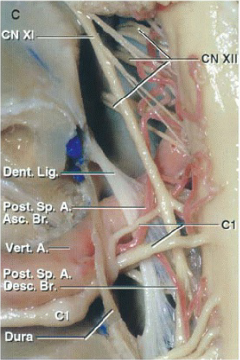 NXI o;nt. Ид. ost.Sp. А: vert: А.— Post. Sp. А. • esc. Вт. Dura 