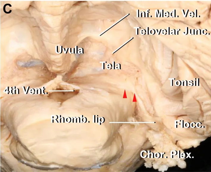Posteroinferior view of the brainstem and cerebellum. 