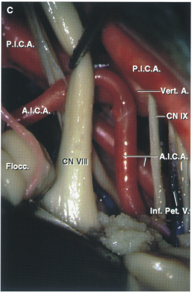 p.{.c.A. CN WII F loec: P.I.C.A. —Vert A. CNIX l.c. . .'Pet V. 