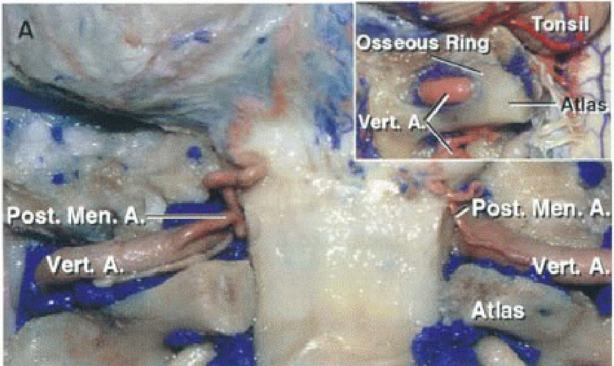 Close-up of a human body AI-generated content may be incorrect.