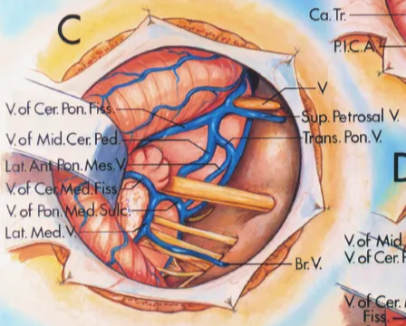 Cer Pon Fiss. Mid.Cer Pee. flocculus Porn. M Cho r. Cerfbn Fi V. of R)n. V.of Mid.Cer VSE C Lai Med. r ped. Carr V ns. pon.V V of Cer. .ic.A. sc.A. AICA. VII,VIII Wrt.A. S.C.A. sal V Vert A, 