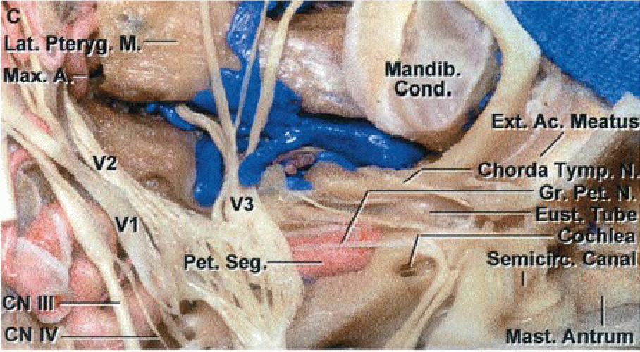 Mandib. Condo, Ac. MeatuS —4C'yprda Tym ntru 