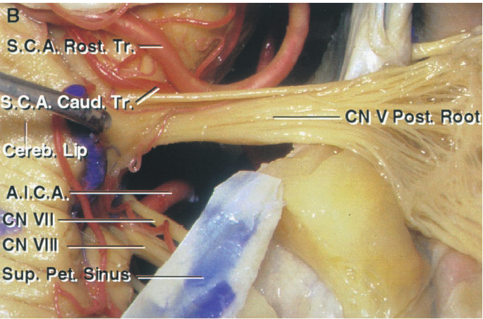 . cau CN V Post.-fiöo A.I.C.A. Vil CN Vlll Sup>Pe i u 