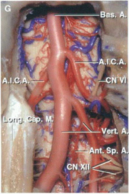 Bas. A. ic.A. Vert A SP. A. 