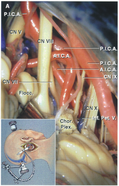 Close-up of a human body AI-generated content may be incorrect.