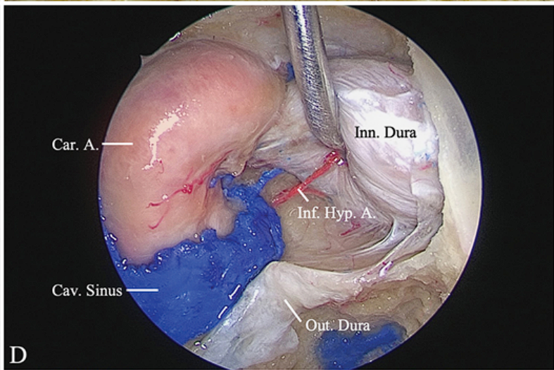 • — snu!S 'Aeo e.m(l •uuł 