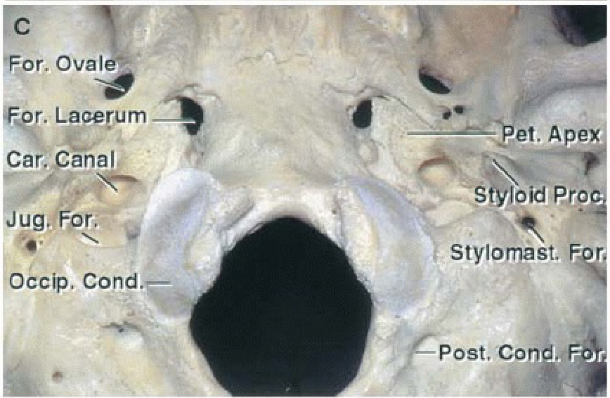 Jugular foramen viewed from directly below.
