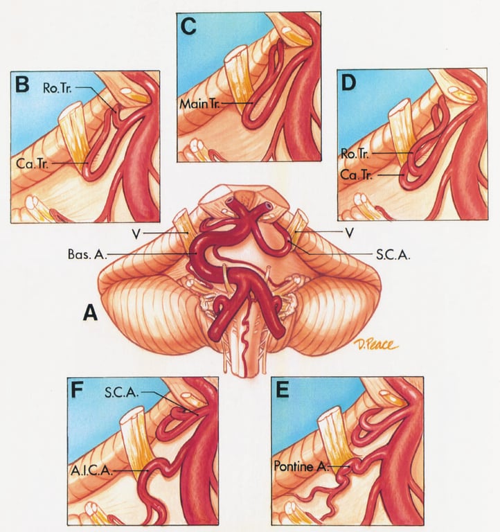 B RO.Tr. Main Ca. r: Bas. A. SC.A. Q. face— 