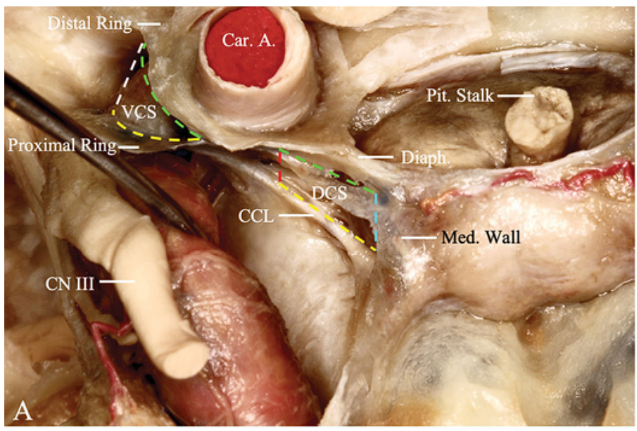*Stal RiriÉ+•-.« Car. A. Pit. Stalk ed. Wall 111 