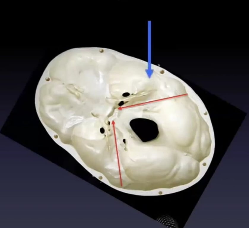 A white skull with holes in it AI-generated content may be incorrect.