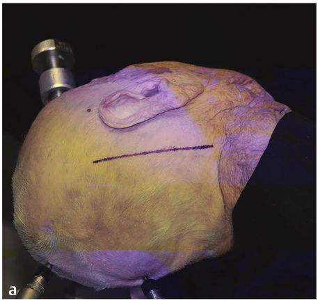 A head with a line drawn on it AI-generated content may be incorrect.