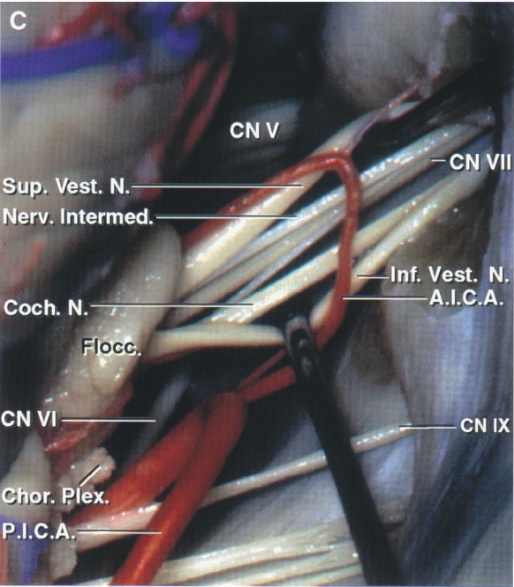 Close-up of a human body AI-generated content may be incorrect.