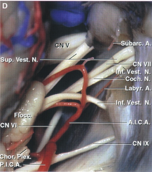 CNV up. Vest. N. CN vir,• or .l.c. •stibarc. A. coc Inf. V ,I.C.A. CN IX 