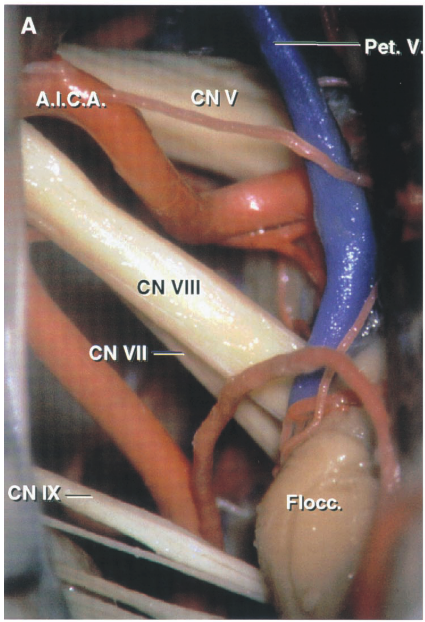 .A.I.SA CN CN' Vll .loccÉ 