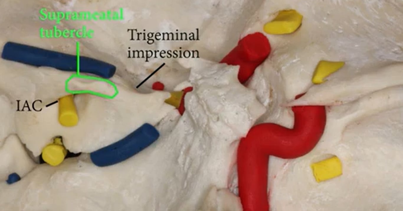 A model of a human body AI-generated content may be incorrect.