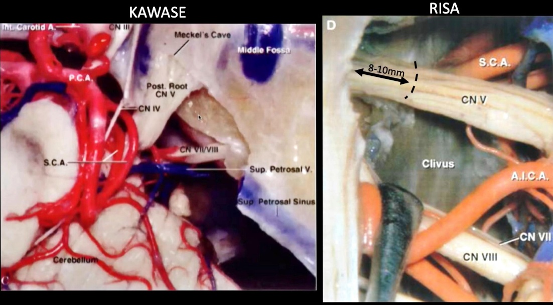 Close-up of a human body anatomy AI-generated content may be incorrect.