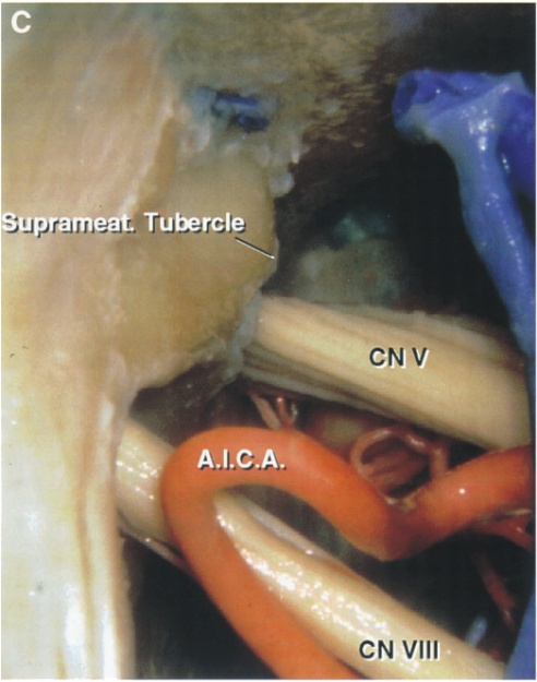 uprame TutErcIe A.i.C.Â. CN VIII 