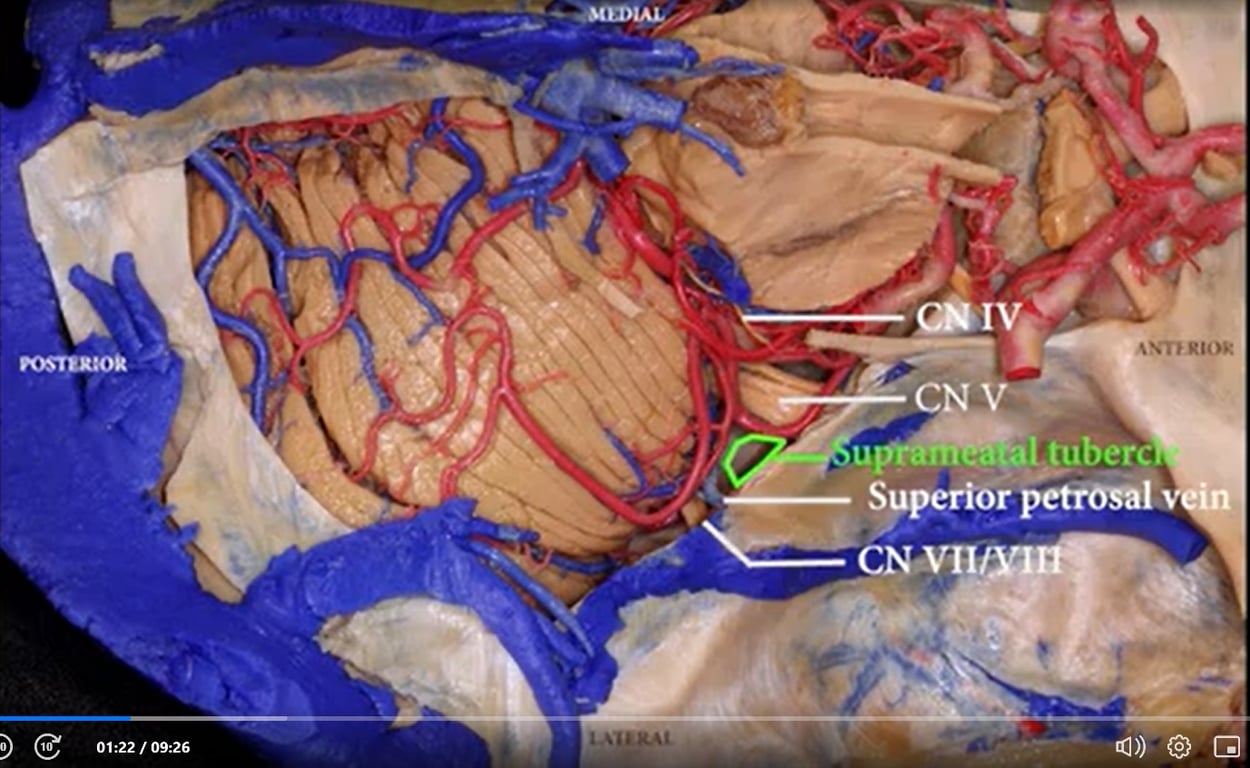 Close-up of a human body AI-generated content may be incorrect.