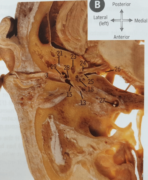 An axial cut through the Left petrous bone