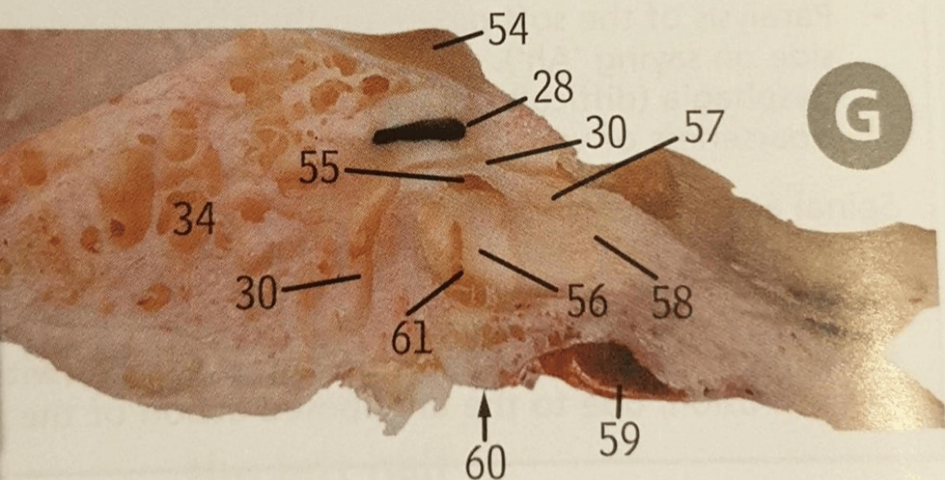 A sagittal cut through the middle ear. 